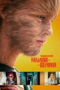 Реальна історія хлопчика-вовченя